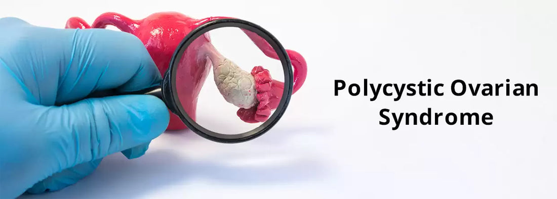 3 Symptoms of Polycystic Ovary Syndrome